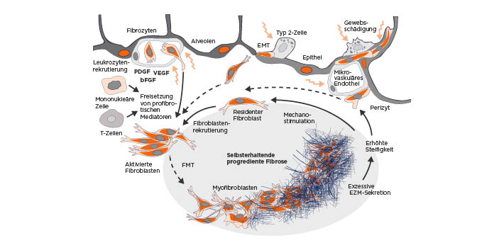 Pathomechanismus der chronischen PF-ILD