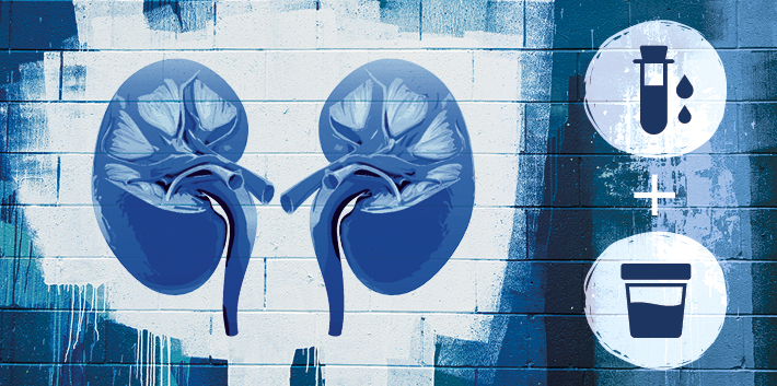 Chronische Niereninsuffizienz mit einfachen Tests frühzeitig erkennen