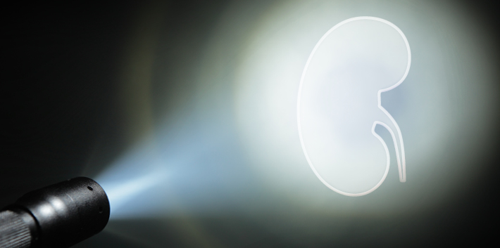 Chronische Niereninsuffizienz: Gefahr rechtzeitig erkannt?