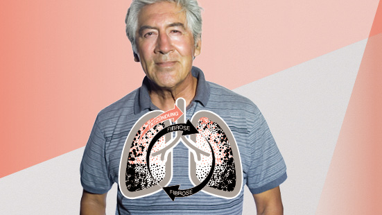 Bei Lungenfibrose keine Zeit verlieren