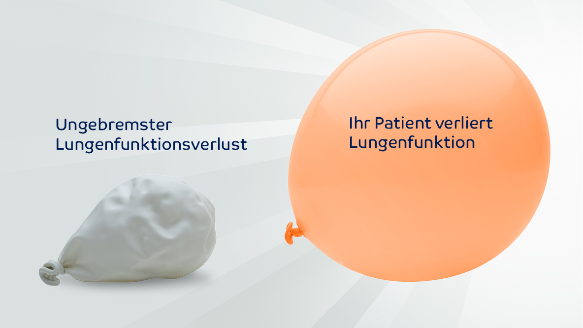 großer praller Luftballon und kleiner, verschrumpelter Luftballon fast ohne Luft symbolisieren den ungebremsten Lungenfunktionsverust bei unbehandelter Lungenfibrose 