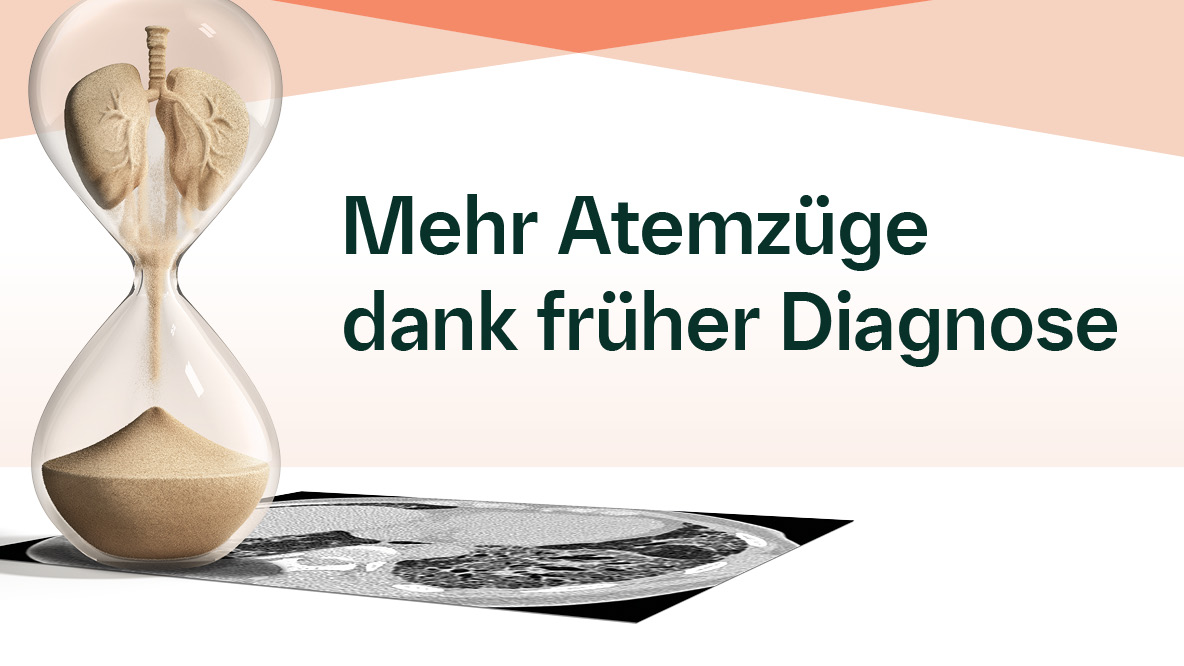Mehr Atemzüge Dank früher Diagnose bei Lungenfibrose