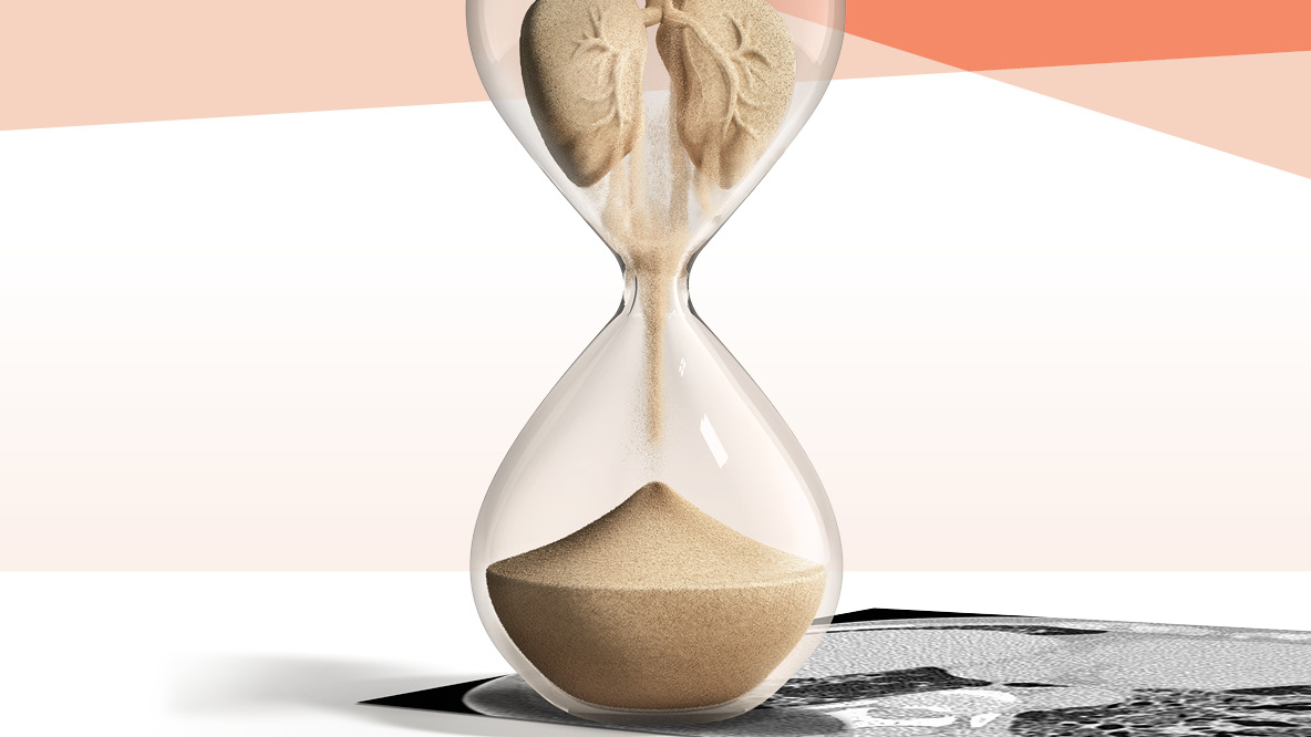 Kennen Sie die Gefahren? Lernen Sie die Risiken einer Lungenfibrose bei rheumatoider Arthritis kennen.