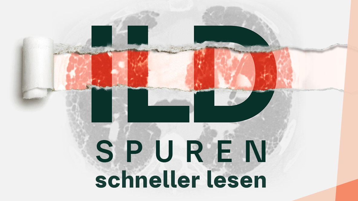 ILD-Spuren schneller lesen