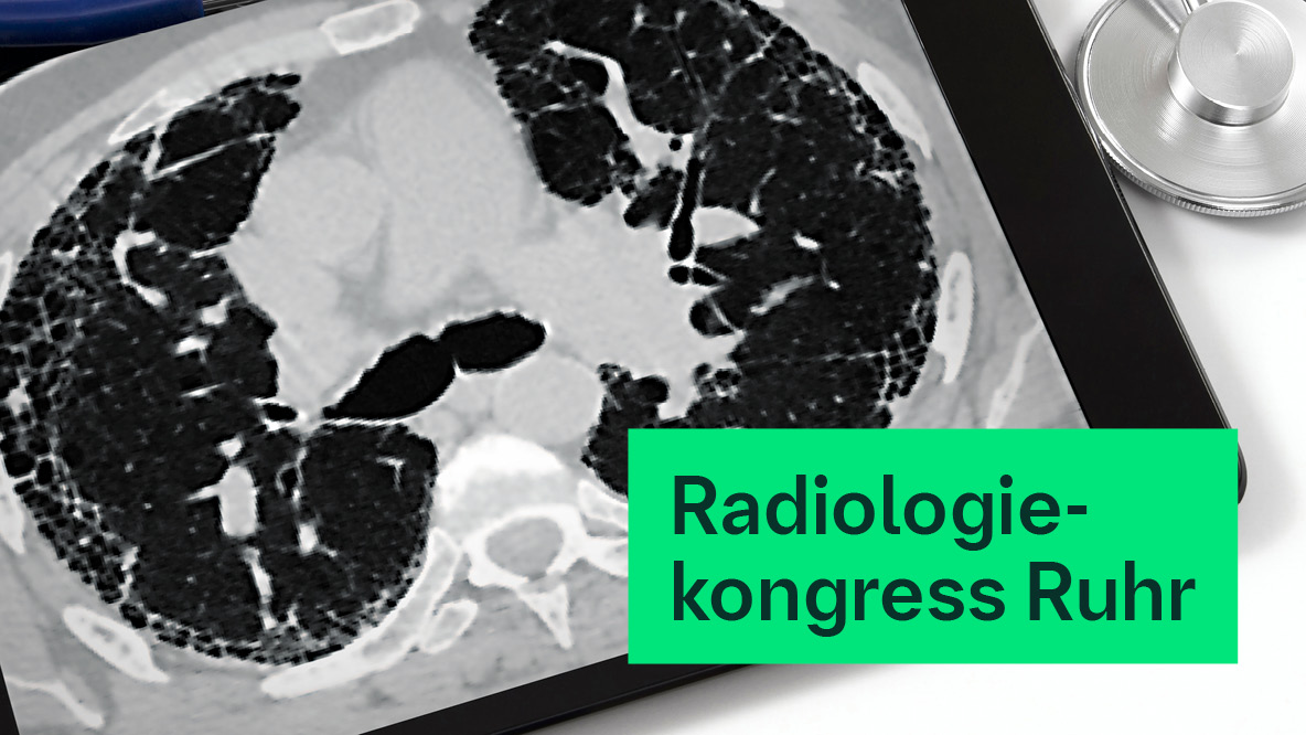 Boehringer Ingelheim auf dem Radiologiekongress Ruhr