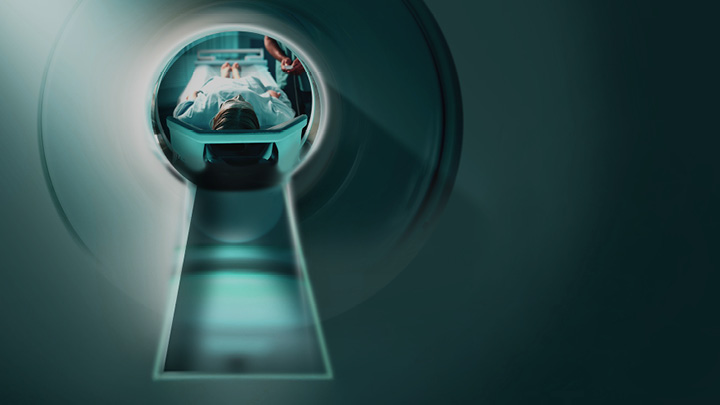 ILD & HRCT: Diagnostik, Mustererkennung & Differentialdiagnose