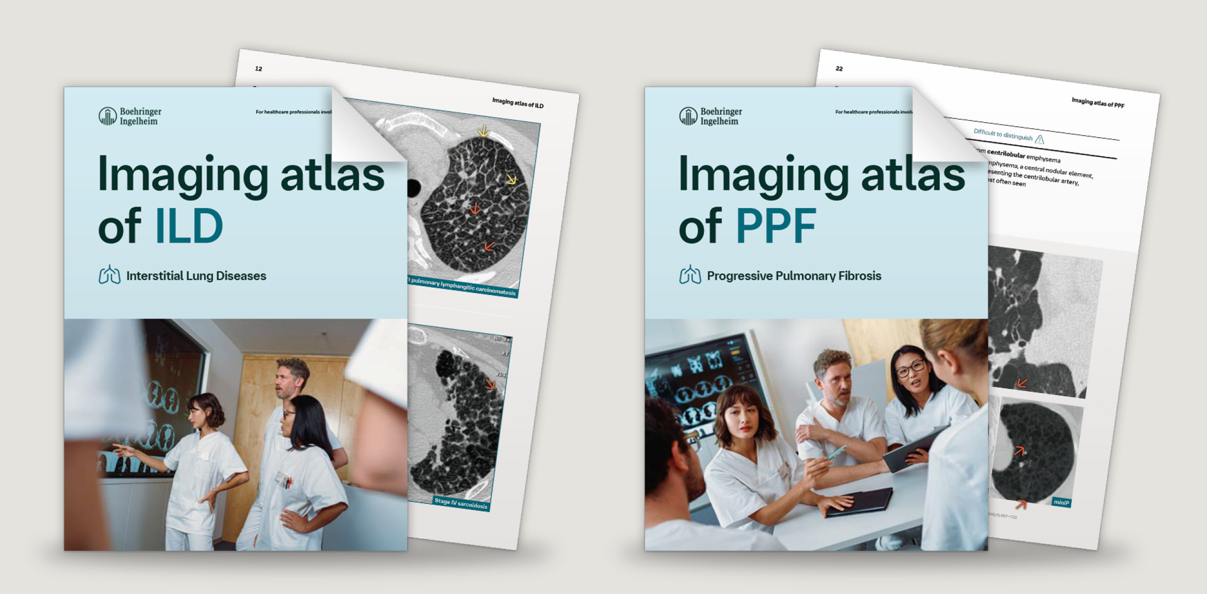 HRCT-Bilder der Lunge: Bildatlanten zu ILD und PPF