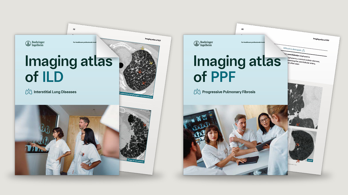 HRCT Bildatlanten für ILD und PPF