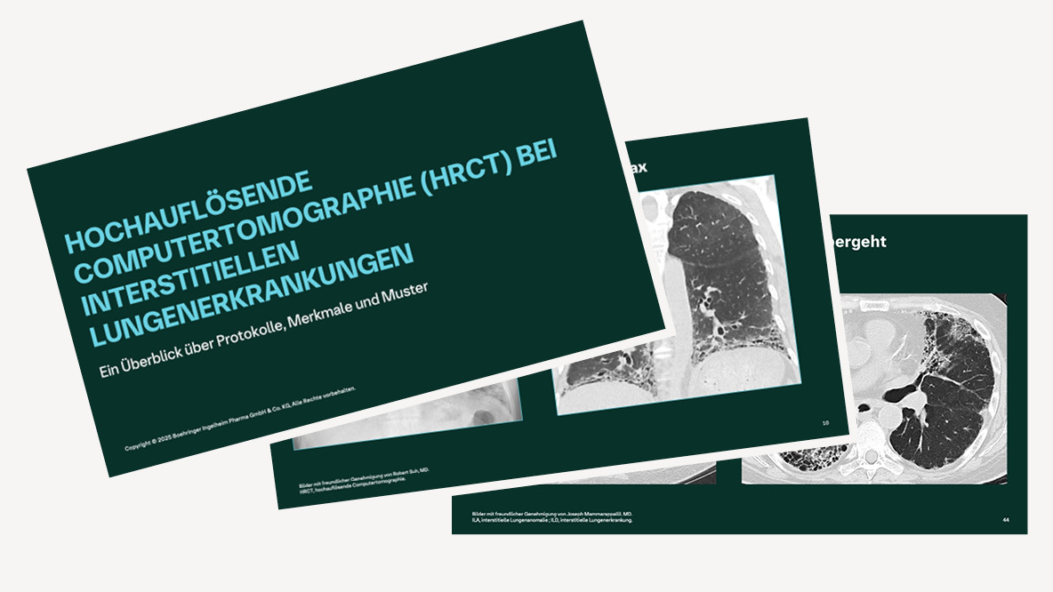 Vorschau Slideset "Hochauflösende Computertomographie (HRCT) bei interstitiellen Lungenerkrankungen"