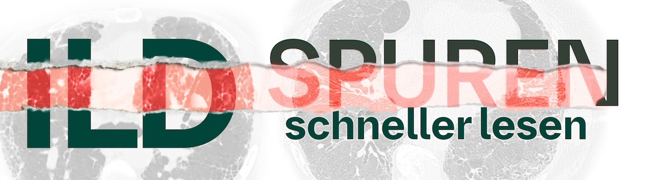 ILD-Spuren schneller lesen – unsere Serviceangebote für Sie.