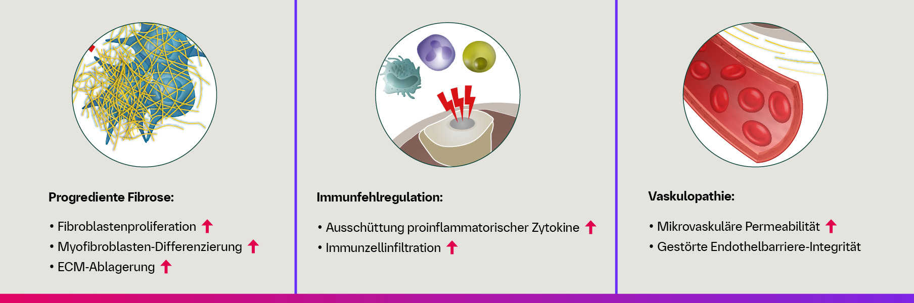 Infografik: PDE4B baut cAMP ab, was zu niedrigen cAMP-Spiegeln führt und eine Verstärkung von Fibrose, Immunfehlregulation sowie vaskuläre Instabilität zur Folge hat