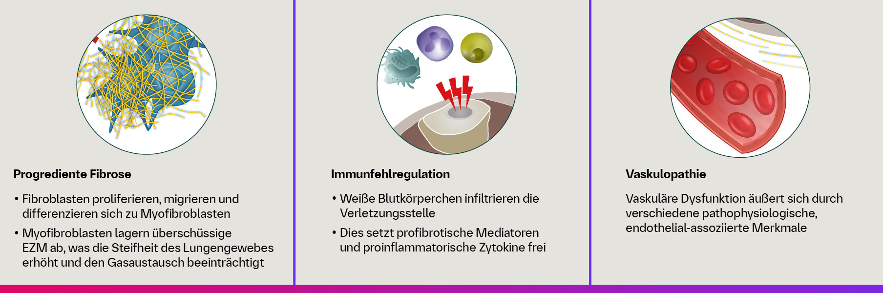 Infografik zum Zusammenspiel aus fortschreitender Fibrose, Immundysregulation und Vaskulopathie
