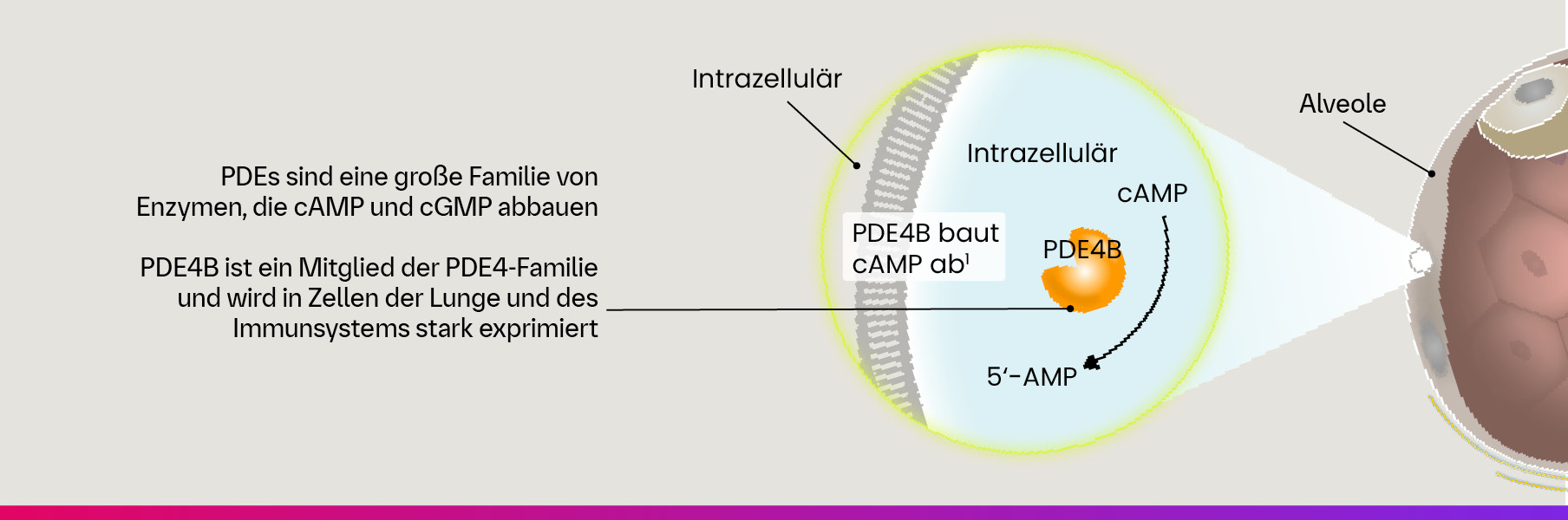Lungenfibrose ist gekennzeichnet durch fortschreitende Fibrose, Immundysregulation und Vaskulopathie