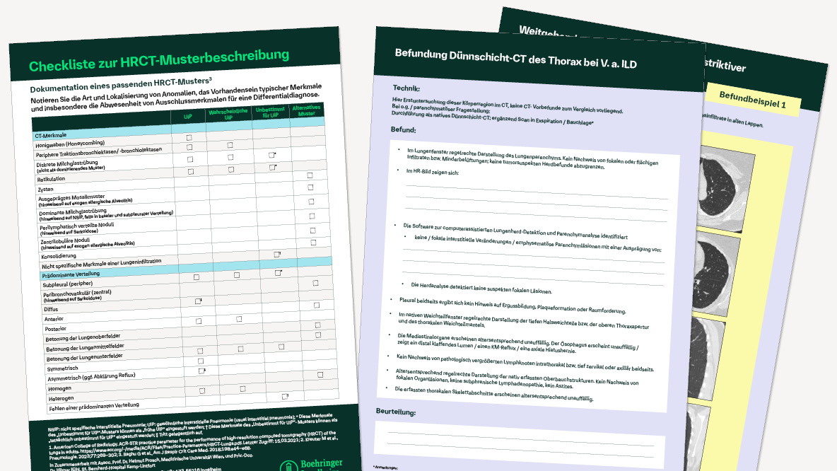 ILD-Diagnostik optimieren: HRCT-Checkliste und Befunddokumentation